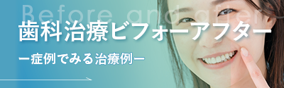 症例